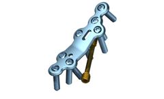 TriLock - Model 2.8 - Fusion Plates