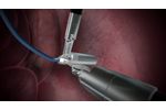 Lightpoint Medical robotic probe SENSEI - Video