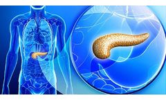 UK Imaging Diabetes Study Seeing Diabetes Clearly - Case Study