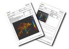 Perspectum - Version MRCP+ - Advanced Biliary Visualisation Software