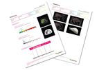Hepatica - Clinical and Surgical Decision Support Tool