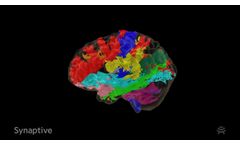 Modus Plan provides easy access to tractography - Video