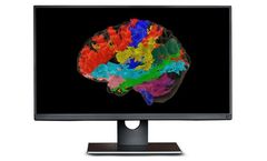 Synaptive ModusPlan - Patient-Specific Tractography System