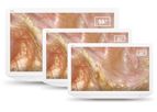 Scivita - Medical 4K LCD Monitor