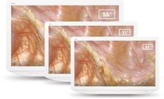 Scivita - Medical 4K LCD Monitor