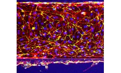 OrganoReady - Blood Vessel HUVEC
