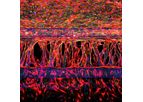OrganoReady - Angiogenesis HUVEC