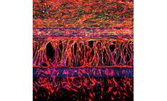 OrganoReady - Angiogenesis HUVEC