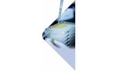 Assay Development and Technology Transfer to Expedite All Clinical Phases