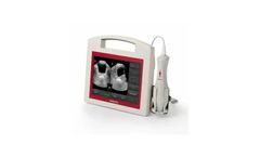 VitaScan - Model PD+ - 100580CP - Bladder Scanner