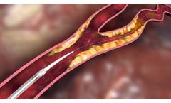 CGuard™ Animation - Video