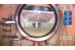 Ocular Ahmed DVX Alignment - Video