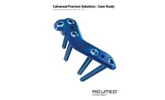 Acumed - Calcaneal Plating System - Brochure