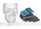 Acumed - OsteoMed ICON Facial Plating System