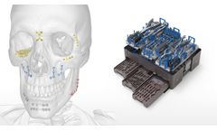 OsteoMed - Model CFx - Craniomaxillofacial Fixation System