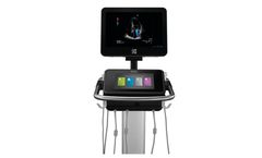 Sonosite - Model X-Porte - Ultrasound Imaging System