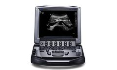 Sonosite - Model M-Turbo - Ultrasound Imaging System
