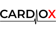Smartwatch blood pressure sensor technology is getting close