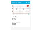 CardioX - Version 6.0 - Mobile App for Wearable ECG Monitor