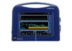 ExSpiron 1Xi - Model Minute - Respiratory Ventilation Monitor
