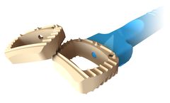 Medicrea IMPIX-MANTA - Cervical Interbody Device