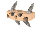 Medicrea IMPIX ALIF SA - Anterior Stand-Alone Lumbar Cage