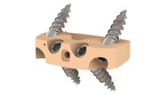 Medicrea IMPIX ALIF SA - Anterior Stand-Alone Lumbar Cage