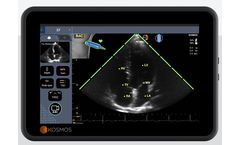 KOSMOS - AI-Assisted Ejection Fraction Workflow Platform