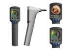 OtoNexus - Technology for Revolutionary Advanced Ultrasound Otoscope