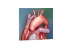 ProxiCor - Model CTR - Extracellular Matrix for Cardiac Tissue Repair