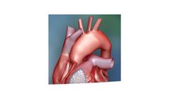 ProxiCor - Model CTR - Extracellular Matrix for Cardiac Tissue Repair