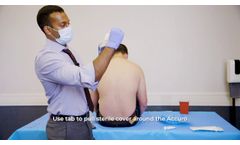 Setting Up the Accuro® Locator Needle Guide and Sterile Cover - Video