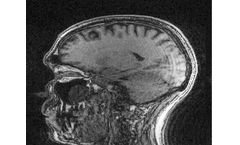 MotionScout - Motion Artifact Correction Imaging System