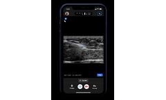Ultrasound for Emergency Medicine