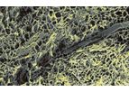 Aroa-Biosurgery - Tissue Extracellular Matrix (ECM)