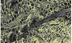 Aroa-Biosurgery - Tissue Extracellular Matrix (ECM)