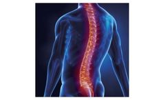 Histocell - Model HC016 - Acute Spinal Cord Injury Platform