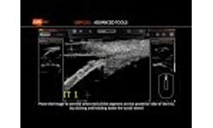 ABSolu Tutorial - Video
