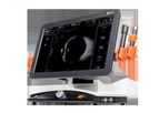 ABSolu - Ultrasound Platform