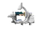 G-Arm Duo - Model B6 - Surgical Imaging System