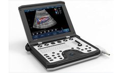 Sigma - Model P5 - Portable Ultrasound System
