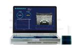EchoSure - Real-Time Blood Flow Visualization Device