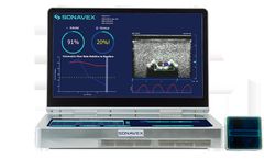 EchoSure - Real-Time Blood Flow Visualization Device