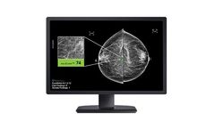 CureMetrix - Version cmAssist - Investigational Computer-Aided Detection (CAD) Software