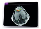 Olea Sphere - Version 3.0 - Groundbreaking MSK Imaging Software
