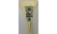 Kinamed - Model MD3T - Multi-Directional Tibial Tubercle Transfer System