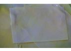 TissX - Biological Tissue Patch