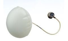 endogAst - Adjustable Totally Implantable Intra Gastric Prosthesis (ATIIP)