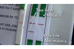 A Cheaper, Easier Way To Test For Malaria - Video