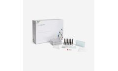 Ausdiagnostics - Model MT-Prep - Nucleic Acids Extraction Kit